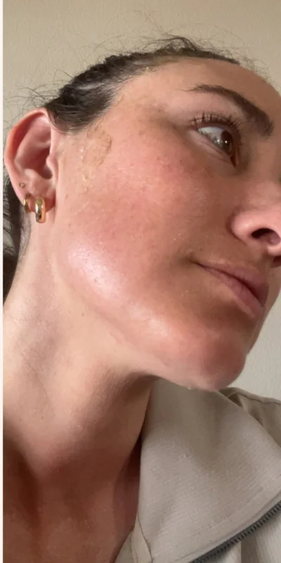 After: ZO Skin Health
