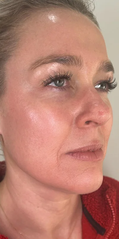 After: ZO Skin Health