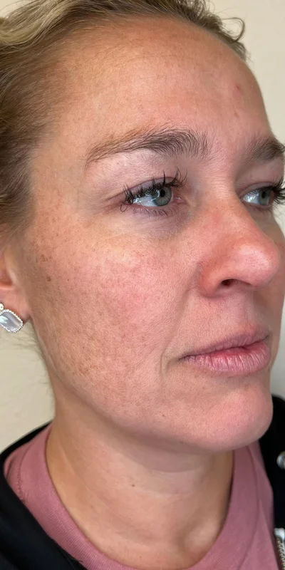 Before: Comprehensive regimen for radiant, healthy skin